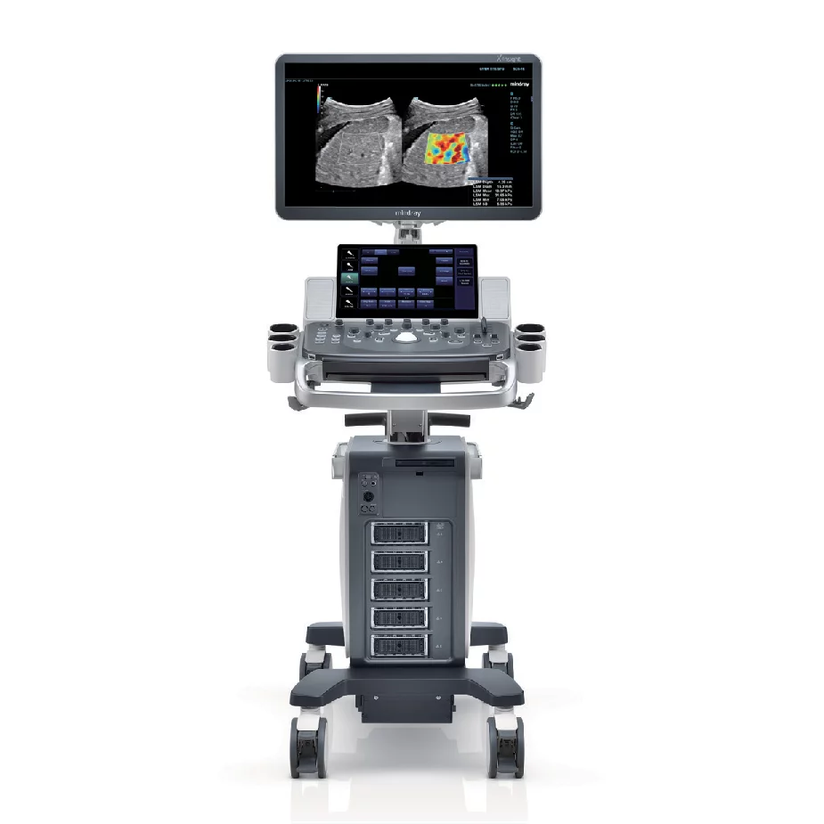 Máy siêu âm 5D Mindray DC80A Máy siêu âm 5D Mindray DC80A